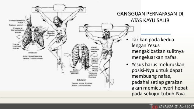 Sisi Medis Penyaliban Tuhan Yesus Kristus