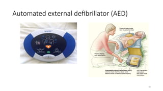 Automated external deﬁbrillator (AED)
20
 