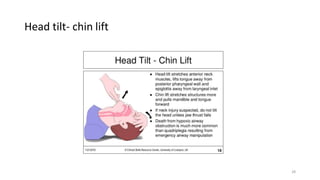 Head tilt- chin lift
28
 