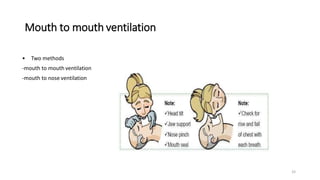 Mouth to mouth ventilation
• Two methods
-mouth to mouth ventilation
-mouth to nose ventilation
33
 