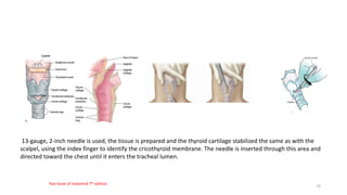 13-gauge, 2-inch needle is used, the tissue is prepared and the thyroid cartilage stabilized the same as with the
scalpel, using the index finger to identify the cricothyroid membrane. The needle is inserted through this area and
directed toward the chest until it enters the tracheal lumen.
Text book of malamed 7th edition
74
 