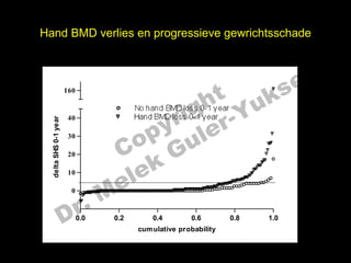 Hand BMD verlies en progressieve gewrichtsschade



                                                                                            el
                                                 t uk                                     s
                                               h
                       160



                                           r ig r-Y
                                              No hand BMD loss 0-1 year


                                          y le
                                              Hand BMD loss 0-1 year
                        40
  delta SHS 0-1 year




                                        p u
                                       o G
                                     C
                        30



                                         k
                        20

                        10

                                    e le
                                   M
                             
                              
                               
                                                                                



                         r.
                         0



                       D     0.0       0.2        0.4         0.6
                                              cum ulative probability
                                                                          0.8       1.0
 