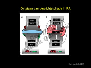 Ontstaan van gewrichtsschade in RA



                                                          el
                      t uk                              s
                    h
                  ig r-Y
                r
               y le
             p u
            o G
          C
           le k
        Me
D r.
Leidt zelfde mechanisme tot BMD verlies en osteoporose?

                                                 Diarra et al, Nat Med 2007
 