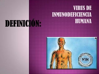 VIRUS DE INMUNODEFICIENCIA HUMANADEFINICIÓN: