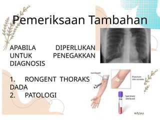 Materi Yustina Linda Yuvita Sari-TBC.pptx