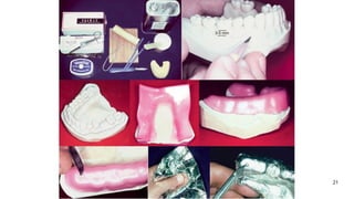 Fixed Impression Impression Techniques used for fixed partial Denture | PPTX