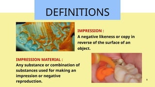 Fixed Impression Impression Techniques used for fixed partial Denture | PPTX