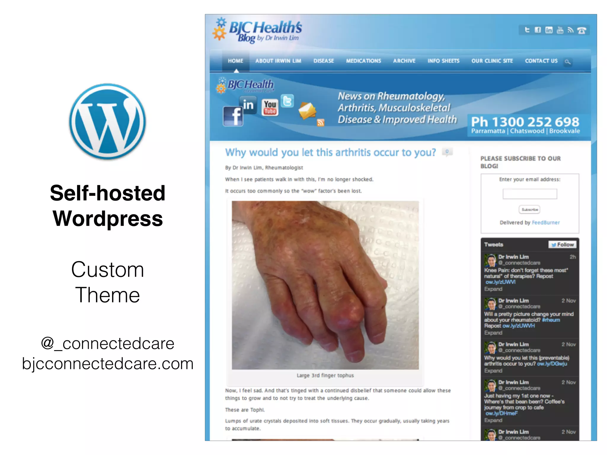 Self-hosted
Wordpress
Custom
Theme
@_connectedcare
bjcconnectedcare.com
 