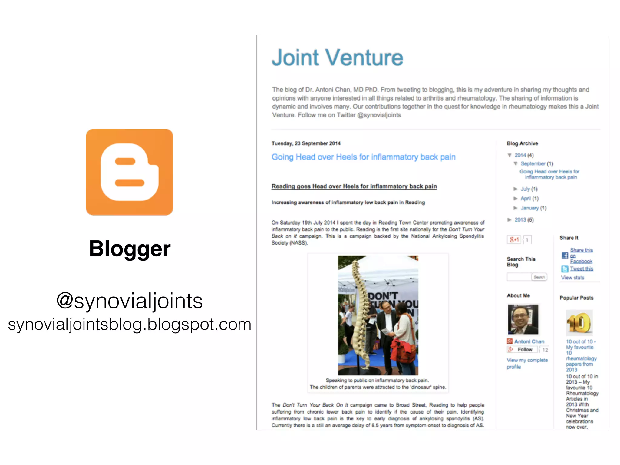 Blogger
@synovialjoints
synovialjointsblog.blogspot.com
 