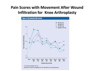 Pain Scores with Movement After Wound
Infiltration for Knee Arthroplasty
 