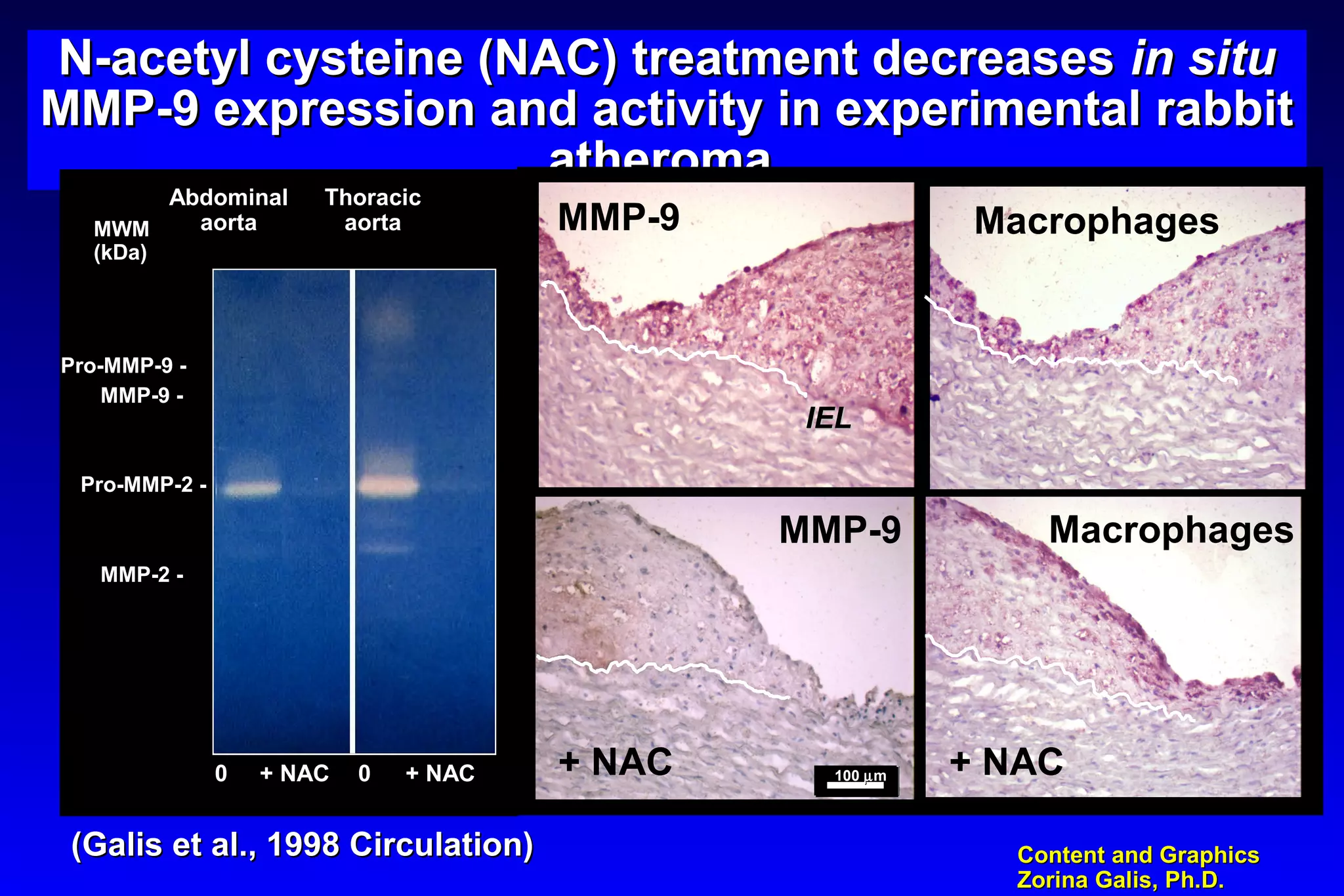 Content and GraphicsContent and Graphics
Zorina Galis, Ph.D.Zorina Galis, Ph.D.
N-acetyl cysteine (NAC) treatment decreasesN-acetyl cysteine (NAC) treatment decreases in situin situ
MMP-9 expression and activity in experimental rabbitMMP-9 expression and activity in experimental rabbit
atheromaatheroma
MMP-9 Macrophages
MMP-9
+ NAC
Macrophages
+ NAC100100 µµmm
IELIEL
Pro-MMP-2 -
MWM
(kDa)
Abdominal
aorta
Thoracic
aorta
+ NAC + NAC0 0
MMP-2 -
Pro-MMP-9 -
MMP-9 -
(Galis et al., 1998 Circulation)(Galis et al., 1998 Circulation)
 