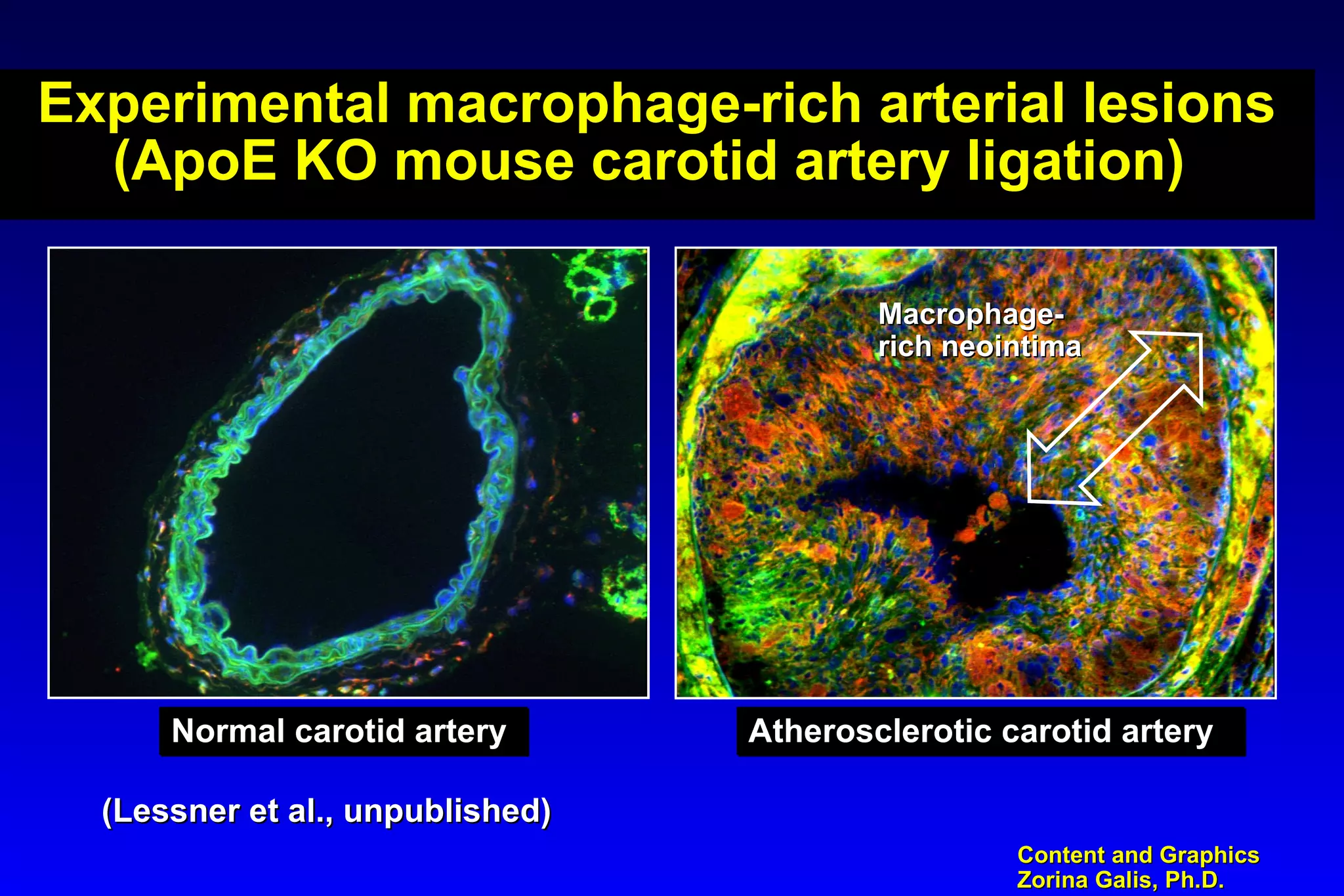 Content and GraphicsContent and Graphics
Zorina Galis, Ph.D.Zorina Galis, Ph.D.
Experimental macrophage-rich arterial lesions
(ApoE KO mouse carotid artery ligation)
Macrophage-Macrophage-
rich neointimarich neointima
Normal carotid arteryNormal carotid arteryNormal carotid arteryNormal carotid artery Atherosclerotic carotid arteryAtherosclerotic carotid arteryAtherosclerotic carotid arteryAtherosclerotic carotid artery
(Lessner et al., unpublished)(Lessner et al., unpublished)
 