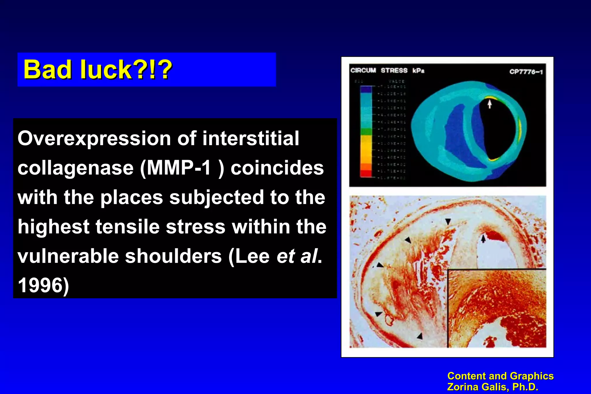 Content and GraphicsContent and Graphics
Zorina Galis, Ph.D.Zorina Galis, Ph.D.
Overexpression of interstitialOverexpression of interstitial
collagenase (MMP-1 ) coincidescollagenase (MMP-1 ) coincides
with the places subjected to thewith the places subjected to the
highest tensile stress within thehighest tensile stress within the
vulnerable shoulders (Leevulnerable shoulders (Lee et alet al..
1996)1996)
Bad luck?!?Bad luck?!?Bad luck?!?Bad luck?!?
 