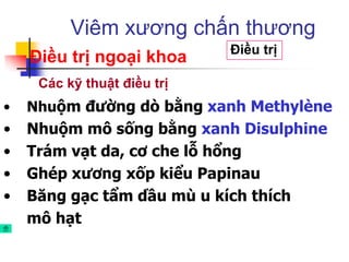• Nhuộm đường dò bằng xanh Methylène
• Nhuộm mô sống bằng xanh Disulphine
• Trám vạt da, cơ che lỗ hổng
• Ghép xương xốp kiểu Papinau
• Băng gạc tẩm dầu mù u kích thích
mô hạt
Viêm xương chấn thương
Điều trị
Điều trị ngoại khoa
Các kỹ thuật điều trị
 