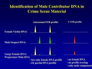 Identification of Male Contributor DNA in
Crime Scene Material
Autosomal STR profile
Female Victim DNA:
Male Suspect DNA:
Large Female DNA:
Perpetrator Male DNA
- See only female DNA profile
- Or partial DNA profile
- no female DNA
- no profile overlap
- only male component
Y STR profile
 