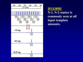 DYS389II
N-1, N-2 stutter is
commonly seen at all
input template
amounts.
1.0 ng
0.5 ng
0.25 ng
 