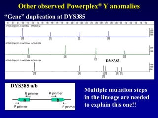 Other observed Powerplex® Y anomalies
DYS385
“Gene” duplication at DYS385
DYS385 a/b
a b
F primer
R primer
F primer
R primer
Multiple mutation steps
in the lineage are needed
to explain this one!!
 