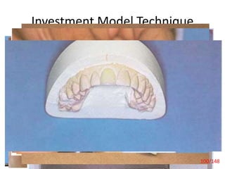 Investment Model Technique
Laminate Veneers 100/148
 