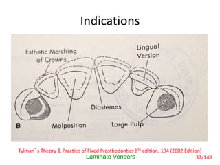 Indications
Laminate Veneers
Tylman’s Theory & Practice of Fixed Prosthodontics 8th edition, 194 (2002 Edition)
37/148
 