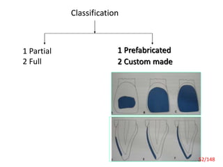 Classification
1 Partial
2 Full
1 Prefabricated
2 Custom made
52/148
 