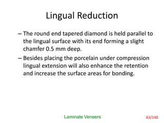 Lingual Reduction
– The round end tapered diamond is held parallel to
the lingual surface with its end forming a slight
chamfer 0.5 mm deep.
– Besides placing the porcelain under compression
lingual extension will also enhance the retention
and increase the surface areas for bonding.
Laminate Veneers 83/148
 