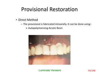 Provisional Restoration
• Direct Method
– The provisional is fabricated intraorally. It can be done using:-
» Autopolymerizing Acrylic Resin
Laminate Veneers 95/148
 