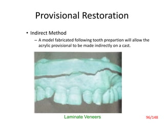Provisional Restoration
• Indirect Method
– A model fabricated following tooth prepartion will allow the
acrylic provisional to be made indirectly on a cast.
Laminate Veneers 96/148
 