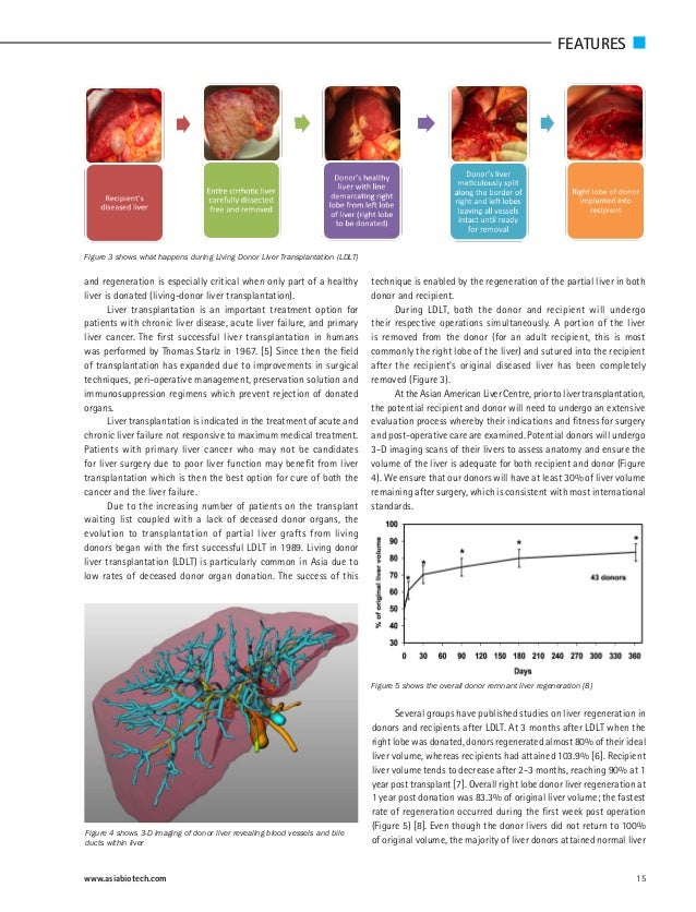 Liver Regeneration Enables Miracle of Liver Transplantation