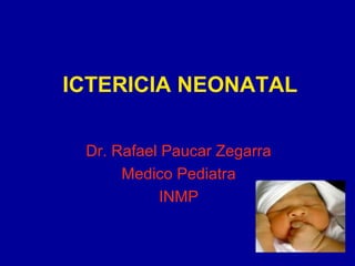 ICTERICIA NEONATAL
Dr. Rafael Paucar Zegarra
Medico Pediatra
INMP
 