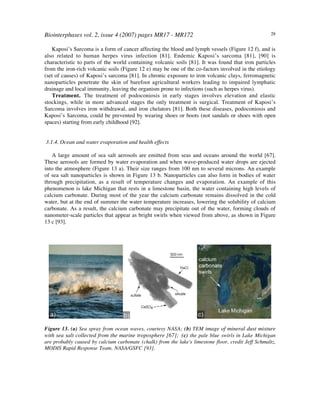 Biointerphases vol. 2, issue 4 (2007) pages MR17 - MR172 28
Kaposi’s Sarcoma is a form of cancer affecting the blood and lymph vessels (Figure 12 f), and is
also related to human herpes virus infection [81]. Endemic Kaposi’s sarcoma [81], [90] is
characteristic to parts of the world containing volcanic soils [81]. It was found that iron particles
from the iron-rich volcanic soils (Figure 12 e) may be one of the co-factors involved in the etiology
(set of causes) of Kaposi’s sarcoma [81]. In chronic exposure to iron volcanic clays, ferromagnetic
nanoparticles penetrate the skin of barefoot agricultural workers leading to impaired lymphatic
drainage and local immunity, leaving the organism prone to infections (such as herpes virus).
Treatment. The treatment of podoconiosis in early stages involves elevation and elastic
stockings, while in more advanced stages the only treatment is surgical. Treatment of Kaposi’s
Sarcoma involves iron withdrawal, and iron chelators [81]. Both these diseases, podoconiosis and
Kaposi’s Sarcoma, could be prevented by wearing shoes or boots (not sandals or shoes with open
spaces) starting from early childhood [92].
3.1.4. Ocean and water evaporation and health effects
A large amount of sea salt aerosols are emitted from seas and oceans around the world [67].
These aerosols are formed by water evaporation and when wave-produced water drops are ejected
into the atmosphere (Figure 13 a). Their size ranges from 100 nm to several microns. An example
of sea salt nanoparticles is shown in Figure 13 b. Nanoparticles can also form in bodies of water
through precipitation, as a result of temperature changes and evaporation. An example of this
phenomenon is lake Michigan that rests in a limestone basin, the water containing high levels of
calcium carbonate. During most of the year the calcium carbonate remains dissolved in the cold
water, but at the end of summer the water temperature increases, lowering the solubility of calcium
carbonate. As a result, the calcium carbonate may precipitate out of the water, forming clouds of
nanometer-scale particles that appear as bright swirls when viewed from above, as shown in Figure
13 c [93].
Figure 13. (a) Sea spray from ocean waves, courtesy NASA; (b) TEM image of mineral dust mixture
with sea salt collected from the marine troposphere [67]; (c) the pale blue swirls in Lake Michigan
are probably caused by calcium carbonate (chalk) from the lake's limestone floor, credit Jeff Schmaltz,
MODIS Rapid Response Team, NASA/GSFC [93].
 