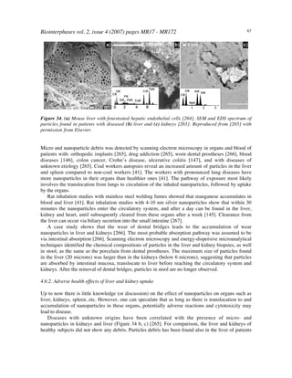 Biointerphases vol. 2, issue 4 (2007) pages MR17 - MR172 67
Figure 34. (a) Mouse liver with fenestrated hepatic endothelial cells [264]. SEM and EDS spectrum of
particles found in patients with diseased (b) liver and (c) kidneys [265]. Reproduced from [265] with
permission from Elsevier.
Micro and nanoparticle debris was detected by scanning electron microscopy in organs and blood of
patients with: orthopedic implants [265], drug addiction [265], worn dental prostheses [266], blood
diseases [146], colon cancer, Crohn’s disease, ulcerative colitis [147], and with diseases of
unknown etiology [265]. Coal workers autopsies reveal an increased amount of particles in the liver
and spleen compared to non-coal workers [41]. The workers with pronounced lung diseases have
more nanoparticles in their organs than healthier ones [41]. The pathway of exposure most likely
involves the translocation from lungs to circulation of the inhaled nanoparticles, followed by uptake
by the organs.
Rat inhalation studies with stainless steel welding fumes showed that manganese accumulates in
blood and liver [41]. Rat inhalation studies with 4-10 nm silver nanoparticles show that within 30
minutes the nanoparticles enter the circulatory system, and after a day can be found in the liver,
kidney and heart, until subsequently cleared from these organs after a week [145]. Clearance from
the liver can occur via biliary secretion into the small intestine [267].
A case study shows that the wear of dental bridges leads to the accumulation of wear
nanoparticles in liver and kidneys [266]. The most probable absorption pathway was assumed to be
via intestinal absorption [266]. Scanning electron microscopy and energy-dispersive microanalytical
techniques identified the chemical compositions of particles in the liver and kidney biopsies, as well
in stool, as the same as the porcelain from dental prostheses. The maximum size of particles found
in the liver (20 microns) was larger than in the kidneys (below 6 microns), suggesting that particles
are absorbed by intestinal mucosa, translocate to liver before reaching the circulatory system and
kidneys. After the removal of dental bridges, particles in stool are no longer observed.
4.6.2. Adverse health effects of liver and kidney uptake
Up to now there is little knowledge (or discussion) on the effect of nanoparticles on organs such as
liver, kidneys, spleen, etc. However, one can speculate that as long as there is translocation to and
accumulation of nanoparticles in these organs, potentially adverse reactions and cytotoxicity may
lead to disease.
Diseases with unknown origins have been correlated with the presence of micro- and
nanoparticles in kidneys and liver (Figure 34 b, c) [265]. For comparison, the liver and kidneys of
healthy subjects did not show any debris. Particles debris has been found also in the liver of patients
 