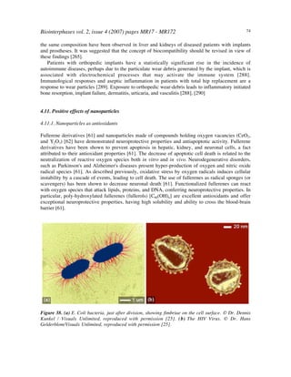 Biointerphases vol. 2, issue 4 (2007) pages MR17 - MR172 74
the same composition have been observed in liver and kidneys of diseased patients with implants
and prostheses. It was suggested that the concept of biocompatibility should be revised in view of
these findings [265].
Patients with orthopedic implants have a statistically significant rise in the incidence of
autoimmune diseases, perhaps due to the particulate wear debris generated by the implant, which is
associated with electrochemical processes that may activate the immune system [288].
Immunological responses and aseptic inflammation in patients with total hip replacement are a
response to wear particles [289]. Exposure to orthopedic wear-debris leads to inflammatory initiated
bone resorption, implant failure, dermatitis, urticaria, and vasculitis [288], [290]
4.11. Positive effects of nanoparticles
4.11.1. Nanoparticles as antioxidants
Fullerene derivatives [61] and nanoparticles made of compounds holding oxygen vacancies (CeO2,
and Y2O3) [62] have demonstrated neuroprotective properties and antiapoptotic activity. Fullerene
derivatives have been shown to prevent apoptosis in hepatic, kidney, and neuronal cells, a fact
attributed to their antioxidant properties [61]. The decrease of apoptotic cell death is related to the
neutralization of reactive oxygen species both in vitro and in vivo. Neurodegenerative disorders,
such as Parkinson's and Alzheimer's diseases present hyper-production of oxygen and nitric oxide
radical species [61]. As described previously, oxidative stress by oxygen radicals induces cellular
instability by a cascade of events, leading to cell death. The use of fullerenes as radical sponges (or
scavengers) has been shown to decrease neuronal death [61]. Functionalized fullerenes can react
with oxygen species that attack lipids, proteins, and DNA, conferring neuroprotective properties. In
particular, poly-hydroxylated fullerenes (fullerols) [C60(OH)n] are excellent antioxidants and offer
exceptional neuroprotective properties, having high solubility and ability to cross the blood-brain
barrier [61].
Figure 38. (a) E. Coli bacteria, just after division, showing fimbriae on the cell surface. © Dr. Dennis
Kunkel / Visuals Unlimited, reproduced with permission [25]. (b) The HIV Virus. © Dr. Hans
Gelderblom/Visuals Unlimited, reproduced with permission [25].
 