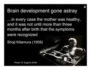 Brain development gone astray
…in every case the mother was healthy,
and it was not until more than three
months after birth that the symptoms
were recognized
Shoji Kitamura (1959)
Photo: W. Eugene Smith
4
 
