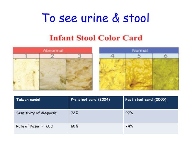 Neonatal jaundice - Dr. Vishnu Biradar