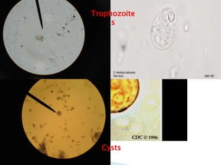 Trophozoite
s
Cysts
 