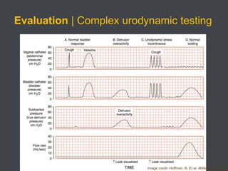 Uds Testing Urinary Incontinence | PPTX