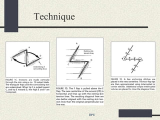 Technique




            DPU
 