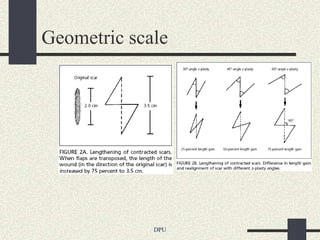 Geometric scale




             DPU
 