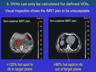3. DVHs can only be calculated for defined VOIs.
 