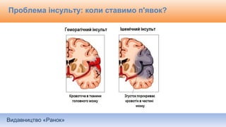 Видавництво «Ранок»
Проблема інсульту: коли ставимо п'явок?
 
