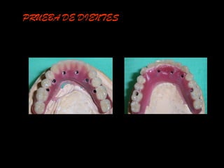 PRUEBA DE DIENTES
 