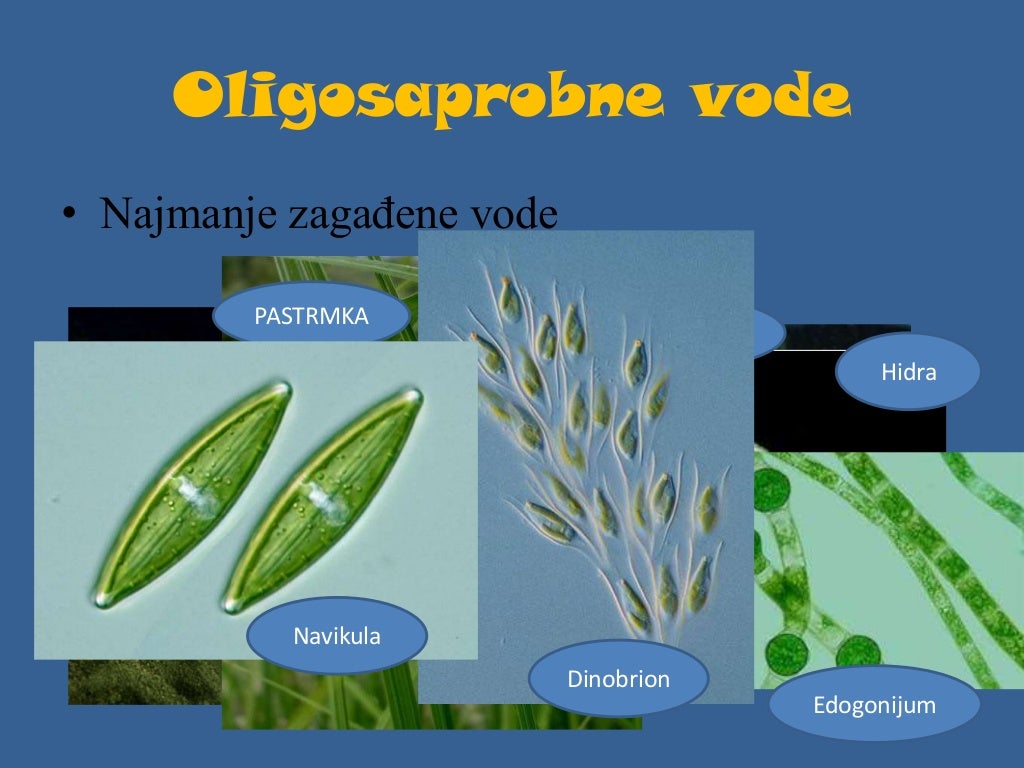 Zagadjivanje vode