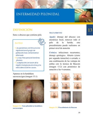 TRATAMIENTO
Seno o absceso que contiene pelo.
                                          Agudo: drenaje del absceso con
                                          anestésico local, remover todo el
                                          pelo     de    la    herida;  este
                                          procedimiento puede realizarse en
                                          primer nivel de atención

                                          Crónico: infecciones recurrentes;
                                          drenaje quirúrgico. Abierto (cierre
                                          por segunda intención) o cerrado; o
                                          una combinación de las ventajas de
                                          ambas con la técnica de Bascom
                                          (imagen 13.2) con pronóstico de
                                          sanación a las 4 semanas.
Aparece en la hendidura
sacrococcigea (imagen 13.1)




Imagen 13.1 Seno pilonidal en hendidura
sacroccocigea                             Imagen 13.2 Procedimiento de Bascom


                                                                                20
 