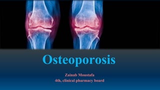 Osteoporosis
Zainab Moustafa
4th, clinical pharmacy board
 