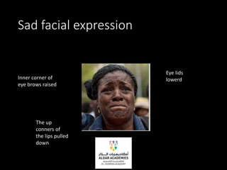 Sad facial expression
Inner corner of
eye brows raised
The up
conners of
the lips pulled
down
Eye lids
lowerd
 