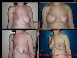 The Ohio State University Medical Center 