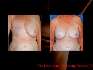 The Ohio State University Medical Center 