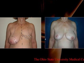 The Ohio State University Medical Center 