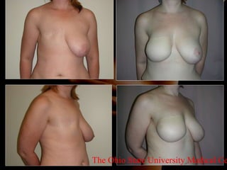 The Ohio State University Medical Center 