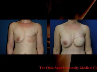 The Ohio State University Medical Center 